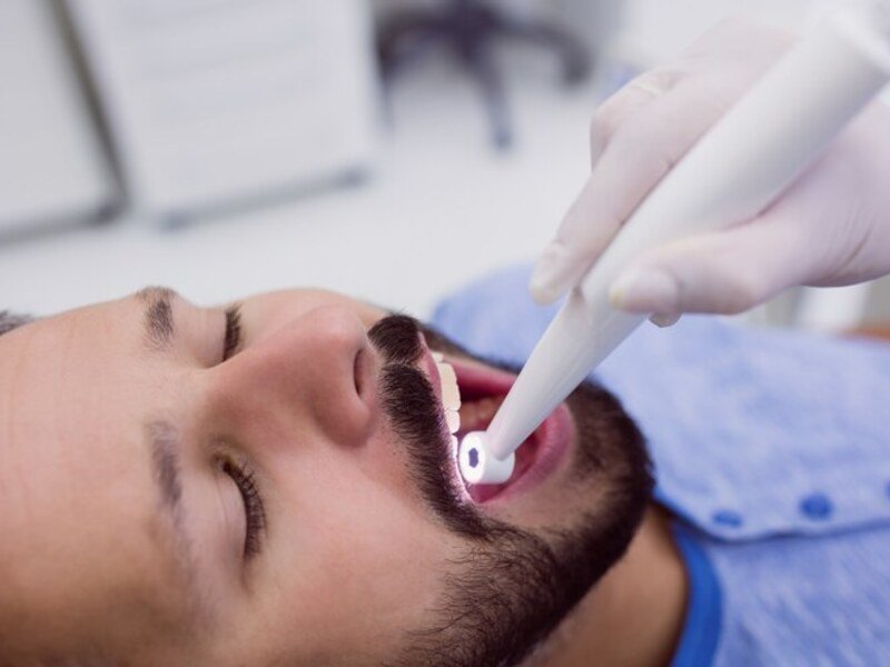 Tooth Extraction Smile Center Islamabad 1