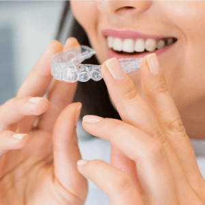 Aligners in islamabad